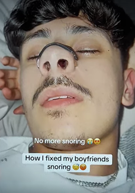 Snore Prevention Gadget Men Women