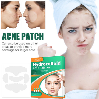 Acne  Patch Full Face Pimple Patches