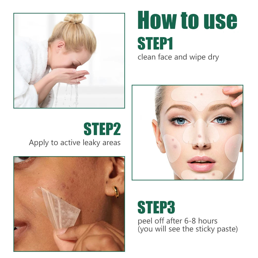 Acne  Patch Full Face Pimple Patches