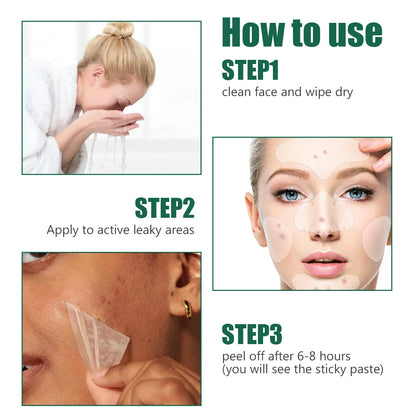 Acne  Patch Full Face Pimple Patches