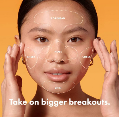 Acne  Patch Full Face Pimple Patches